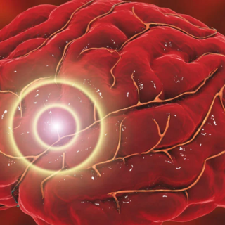 2026 EEH Neuroscience Grand Rounds ENDURING: Neuro-Endovascular Advances - Lessons from the Past, Practice Today, and the Road Ahead Banner